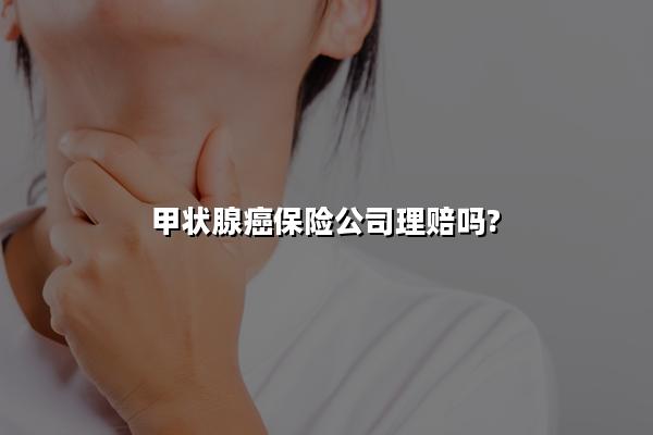 甲状腺癌保险公司理赔吗?甲状腺癌保险是否理赔多少钱?